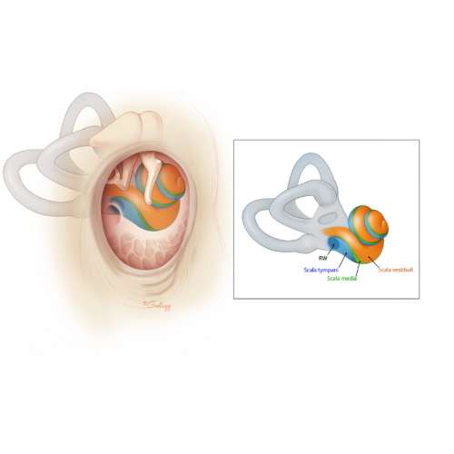 cochlear-2