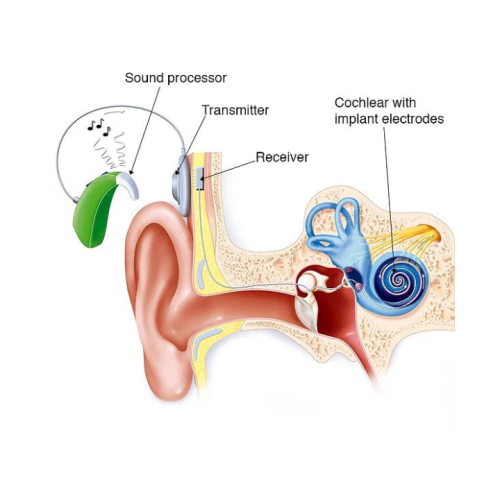 cochlear-3
