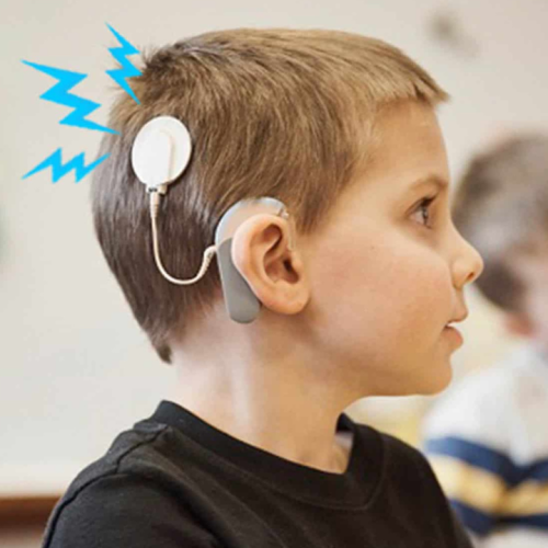 cochlear-4