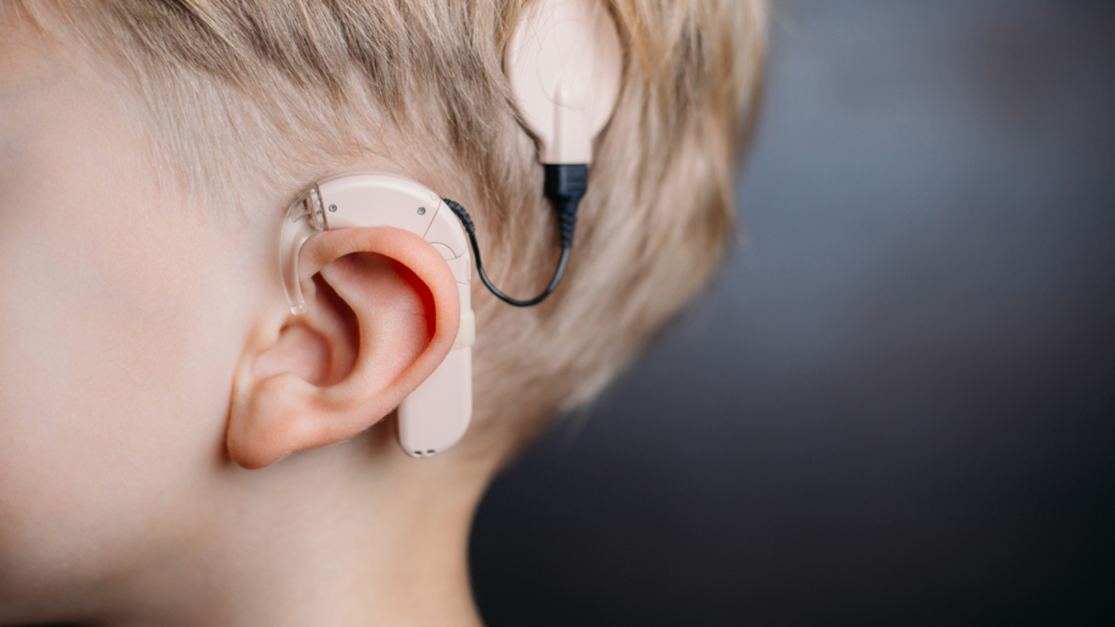 cochlear implant