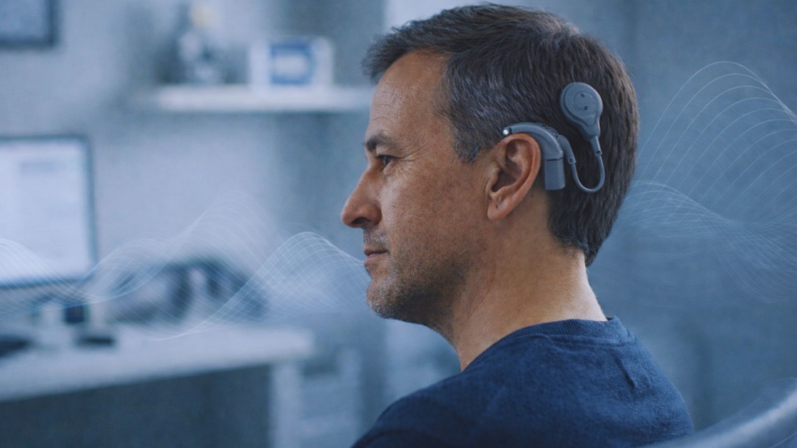 cochlear implants