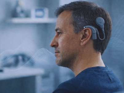 cochlear implants